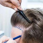 کلینیک زیبایی وکاشت ابرو و مو دکتر قاسمی