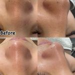 فیشال وپاکسازی تخصصی صورت و بدن اصفهان