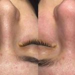 خدمات پاکسازی و فیشال تخصصی پوست نگار